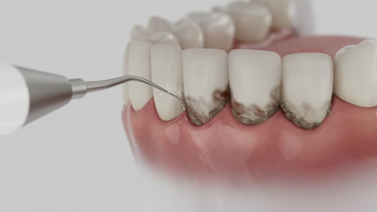 Reliable Dental Implants contractor in Mercer County County, WV by Dentist Open Now